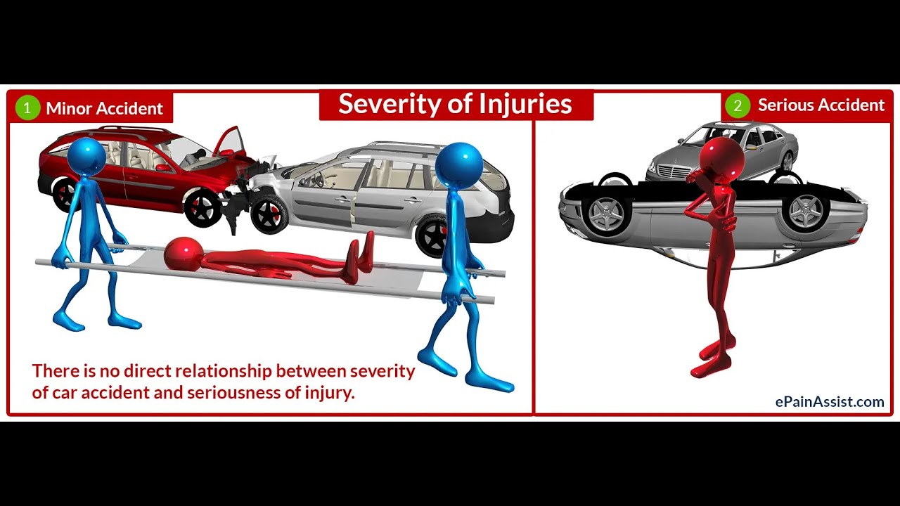 Accident Severity Prediction - Machine Learning Model