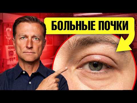 18 внешних признаков, что почки уже страдают