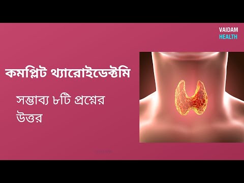 সম্পূর্ণ থাইরয়েডেক্টমি- ৮টি প্রায়শই জিজ্ঞাসিত প্রশ্ন