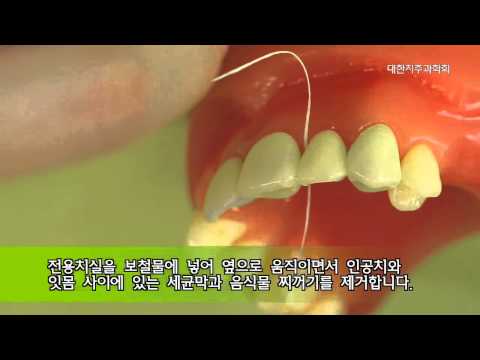 치실 및 치간칫솔 사용법 영상 썸네일