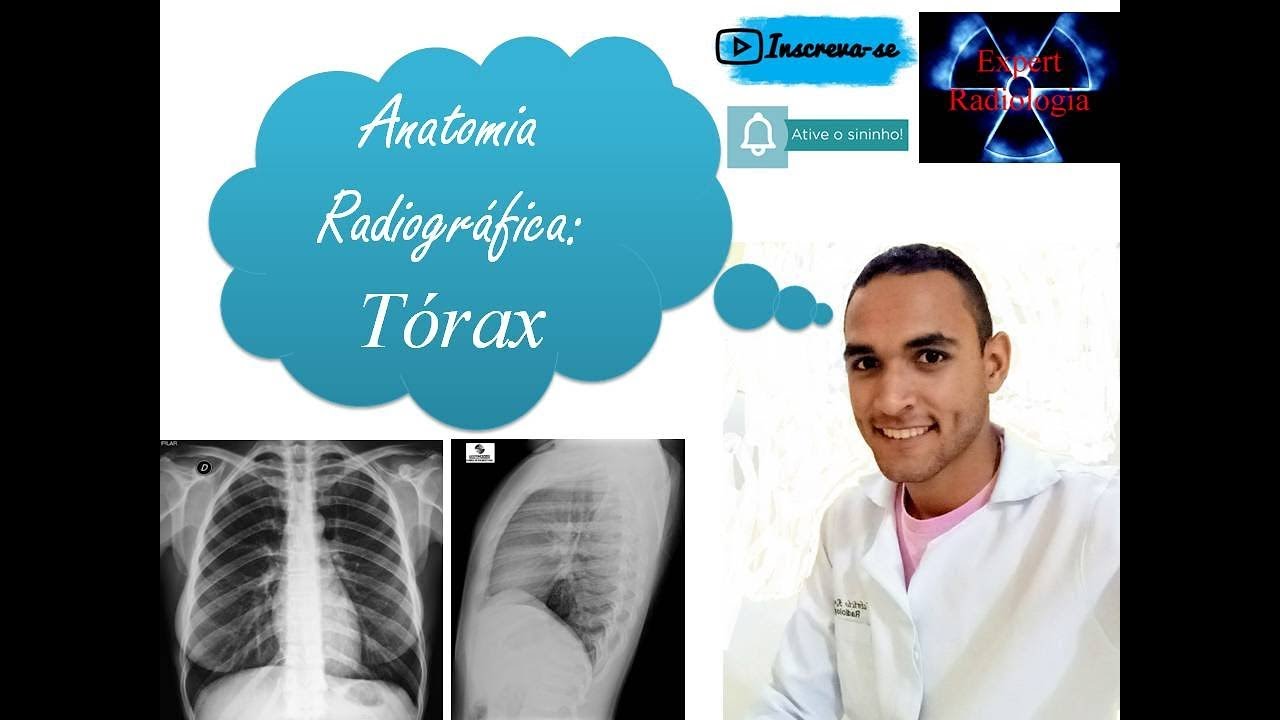 Anatomia radiográfica: Tórax