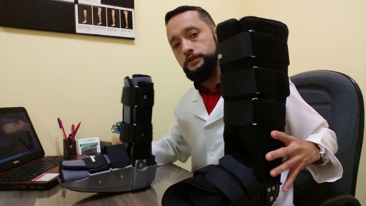 Órtese do Tipo Bota Imobilizadora - No lugar do Gesso! #ortopedia #saude