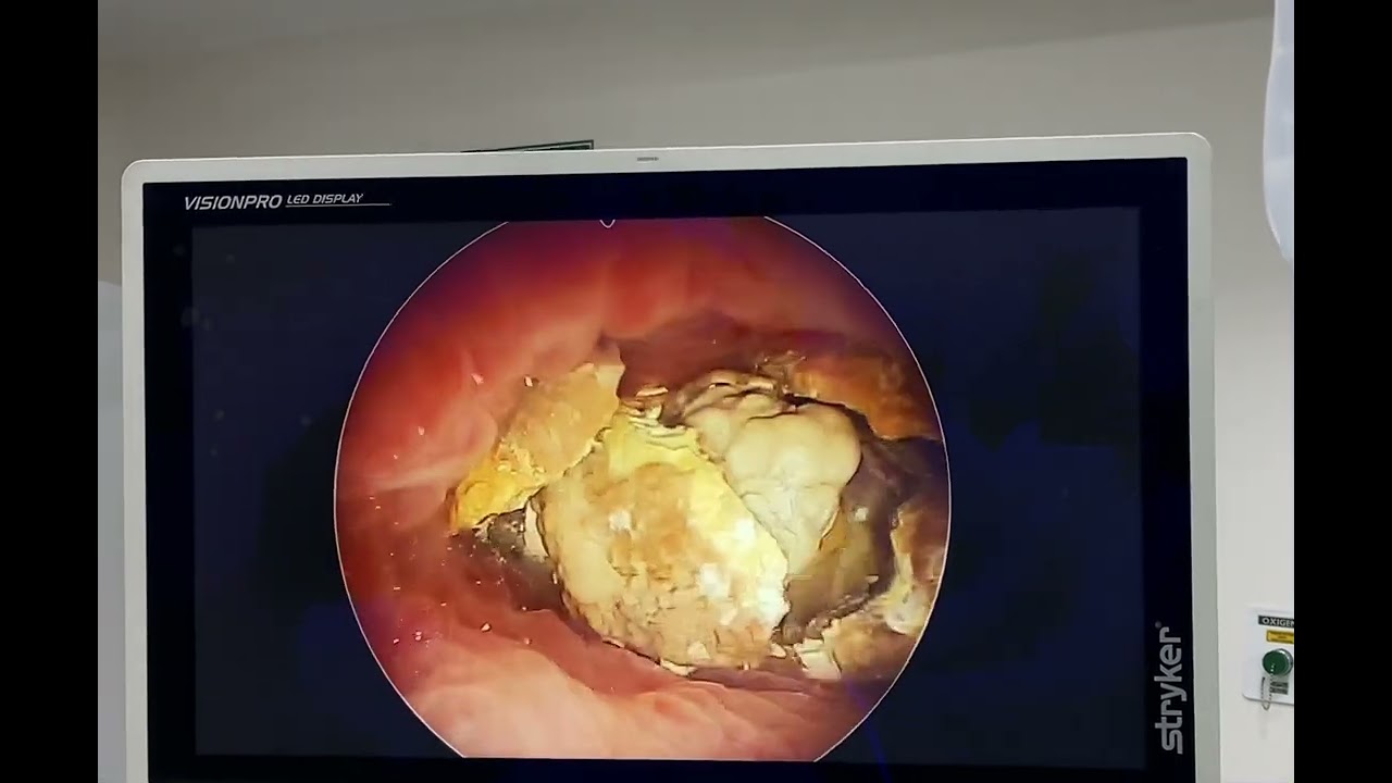 José Humberto Hernández-10