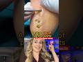 Doctor Reacts Satisfying Wart Removal