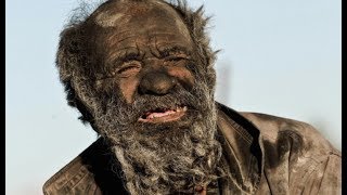 This 80-Year Old Man Hasn't Bathed In Over 60 Years