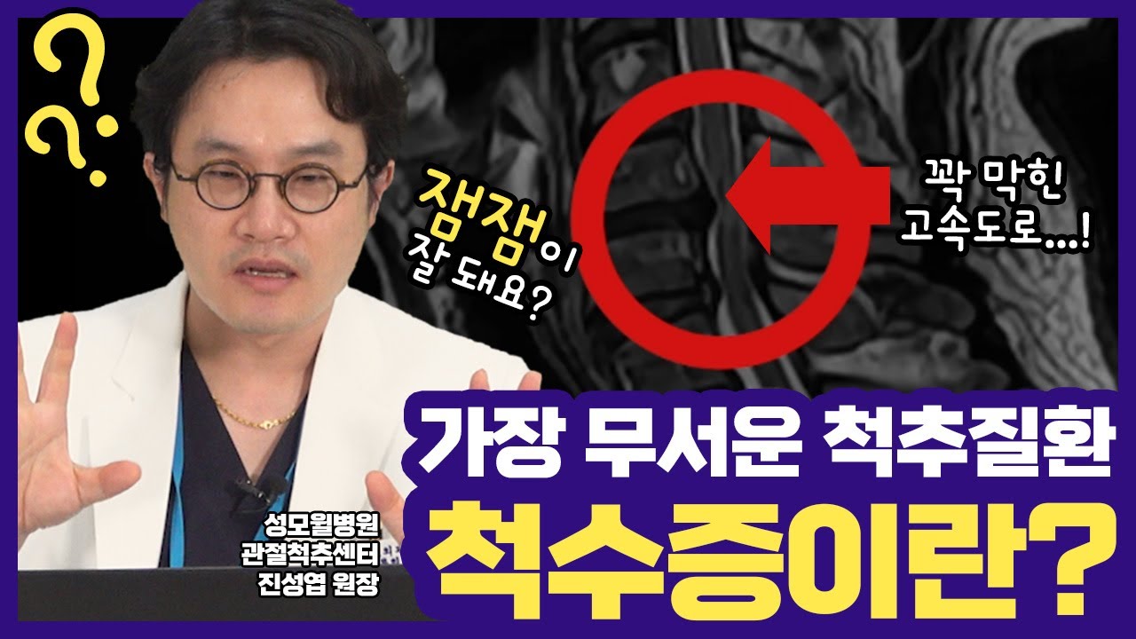 목이 아픈데 팔까지 뜻대로 안 움직이신다면... 척수증 Part 1 (성남 #성모윌병원) 썸네일 이미지