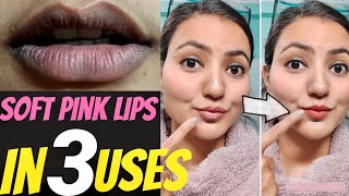 Get Rid of DARK DRY CHAPPED & PIGMENTED LIPS in Just 3 Days | Get PINK SOFT LIPS Naturally at Home