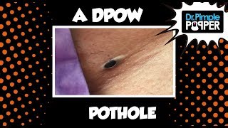 A Little DPOW Pothole