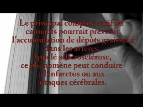 comment soigner tumeur au cerveau