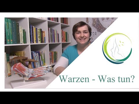 Hogyan lehet eltávolítani a papillómát? Papillómákat, mint hogy visszavonja