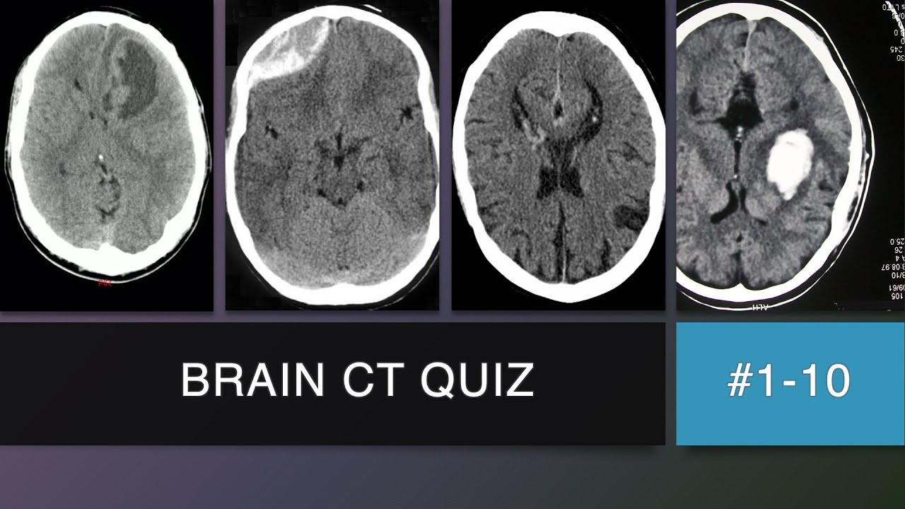Brain CT Scan Quiz #1 - 10