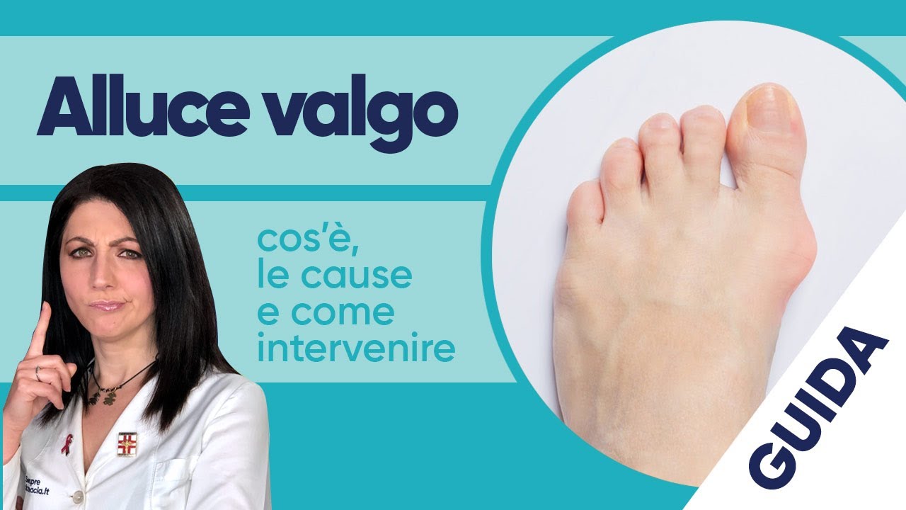 Alluce valgo: cos’è, le cause e come intervenire