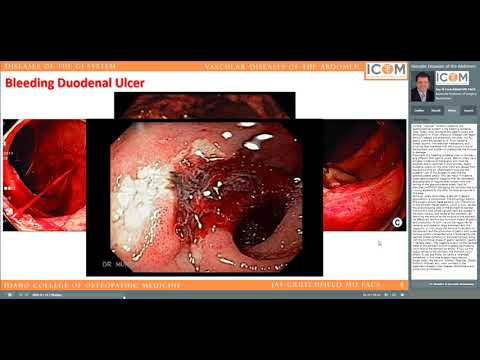 Vascular Diseases of the Abdomen