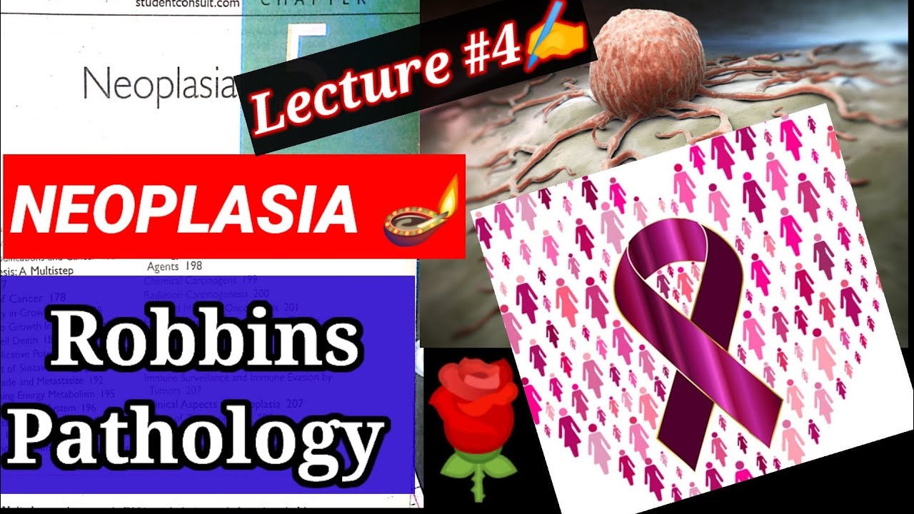 #neoplasia_pathology, Lecture#4 neoplasia pathology robbins, neoplasia pathology lecture. #pathology
