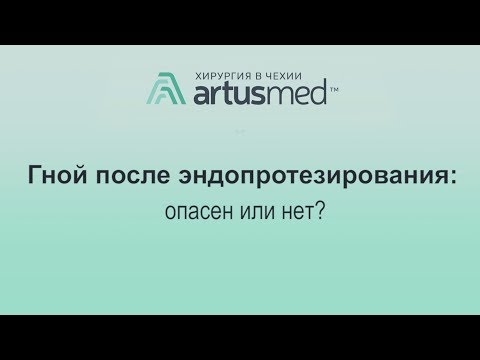 Гной после эндопротезирования сустава - опасен или нет? Лечение инфекции своевременно.