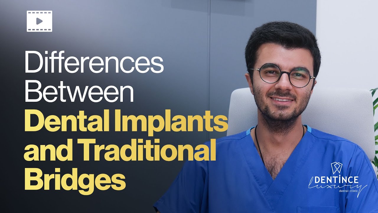 Differences Between Dental Implants and Traditional Bridges