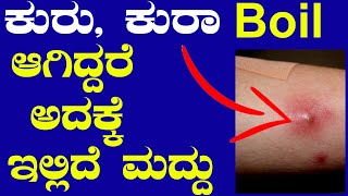 ಕುರು / ಕುರಾ ಸಮಸ್ಯೆಗೆ ಮನೆಮದ್ದು | Boil Symptoms and Treatment | kuruvige mane maddu | Ayurveda Kannada