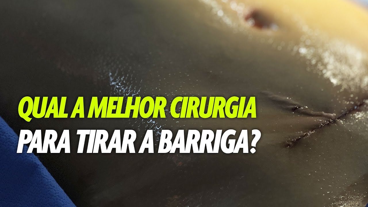 QUAL A MELHOR CIRURGIA PARA TIRAR A BARRIGA CIRURGIA PLASTICA