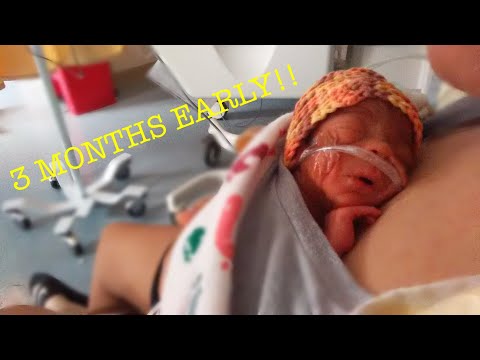 Labor at 28weeks & NICU experience 😣