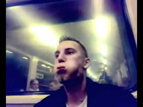 download lagu mp3 mp4 Kieferzittern, download lagu Kieferzittern gratis, unduh video klip Kieferzittern