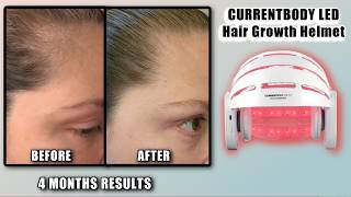 4 MONTH RESULTS | CURRENTBODY LED HAIR GROWTH HELMET
