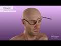 Aaron James's Partial-Face & Total-Eye Transplant Surgical Animation, 2023