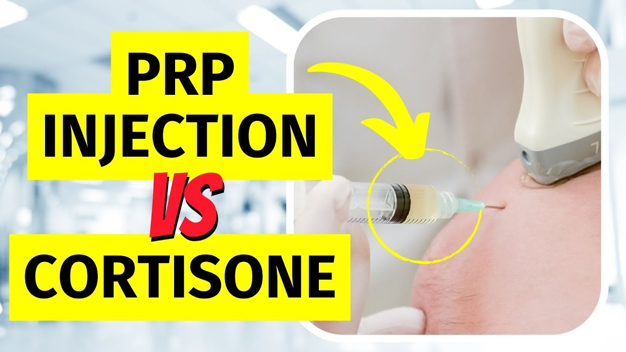 PRP vs Cortisone Injection for Tennis Elbow: What the Research Shows