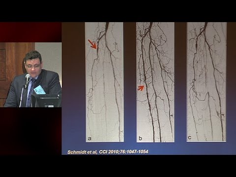 Anatomical and Physiological Factors Affecting Patency After Tibial Intervention
