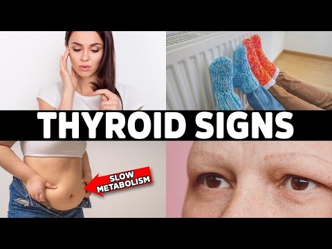 Hyperthyroid vs Hypothyroid Explained By Dr Berg