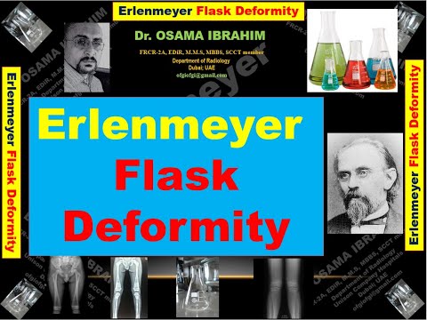 Erlenmeyer Flask Deformity