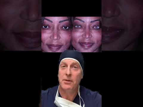 My Confession about Permanently Changing Eye Color