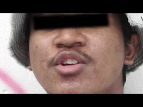 $KYPER - Trufaş (Official Music Video)