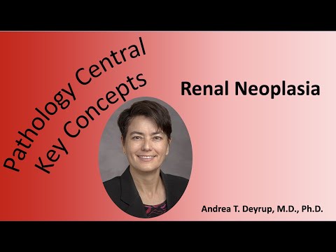 Medical School Pathology: Pathophysiology of Renal Neoplasia