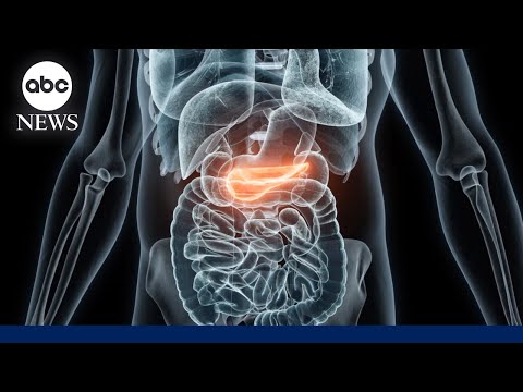 How a new drug could lengthen lives of pancreatic cancer ...