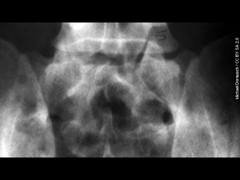 Twitter Learns That Sphincter Preservation Is A Real Degree - Newsy