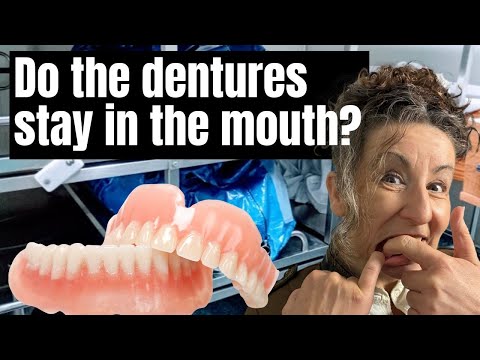 Dentures in the mortuary