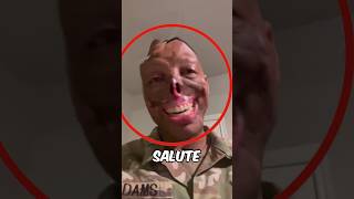 This Soldier Lost His Face While Saving Lives🥺💔