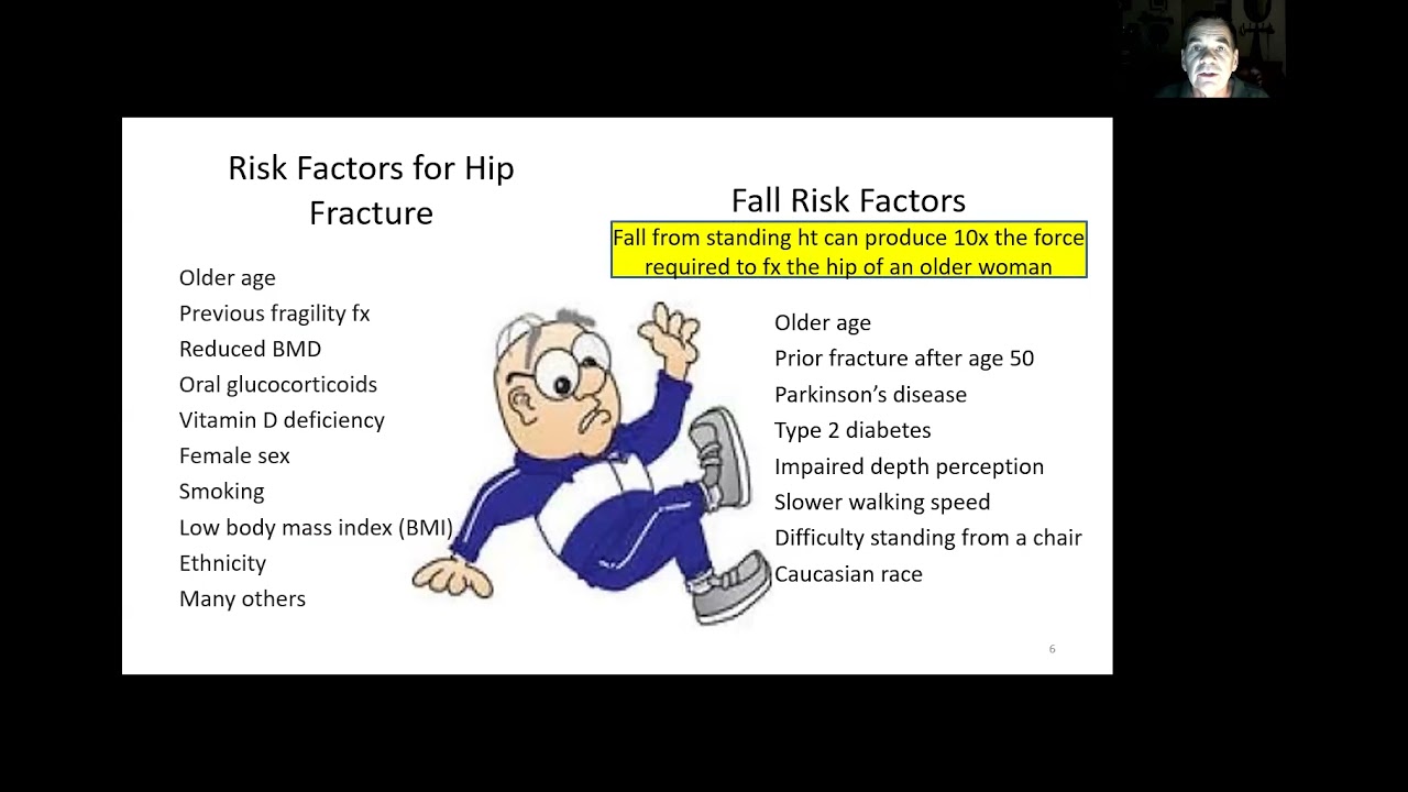 CPG webinar Part 1 of 6_Intro to the CPG and Risk Factors by Herring T, PT, DPT, MA