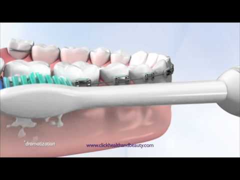 How to use your philips sonicare toothbrush, perfect for bra...