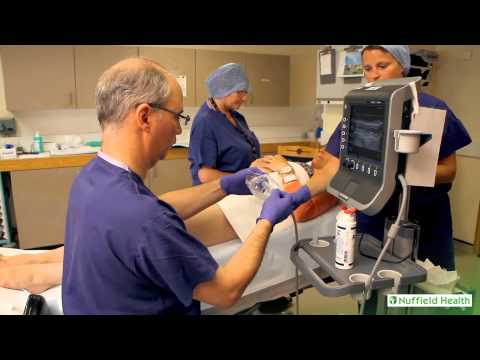 Varicose Vein Treatment at Nuffield Hospital Plymouth