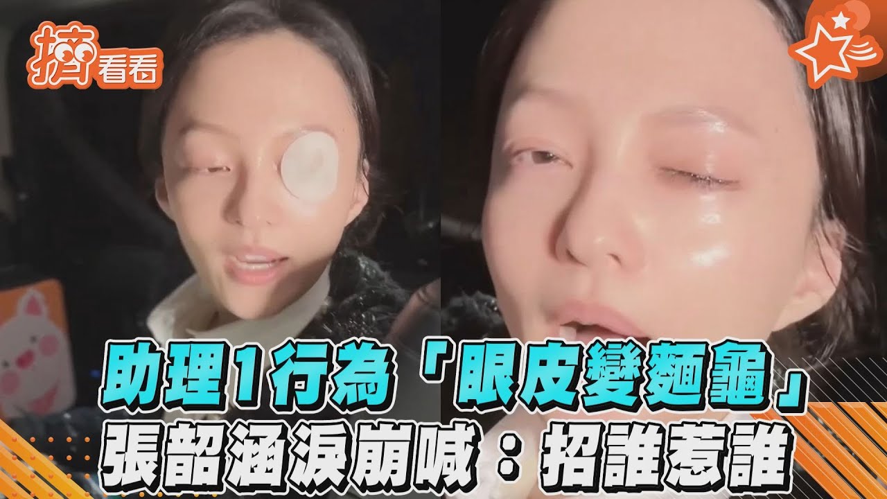 影音/助理1行為「眼皮變麵龜」 張韶涵淚崩喊:招誰惹誰