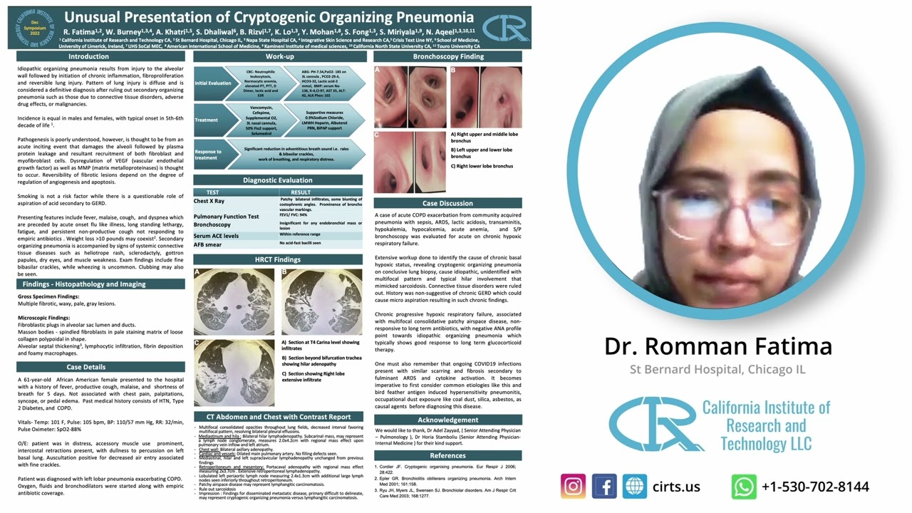 Unusual Presentation of Cryptogenic Organizing Pneumonia - Dr. Romman Fatima