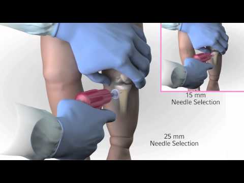 Arrow® EZ-IO® Infant Child Needle Selection and Insertion Technique Animation Video