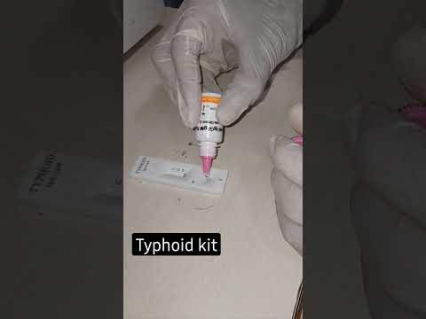 Typhi dot  [IgG & IgM] test procedure 🦠🦠
