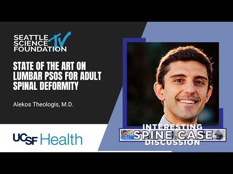 State of the Art on Lumbar PSOs for Adult Spinal Deformity - Alekos Theologis, MD