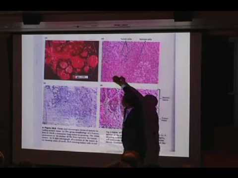 Stem Cells and Cancer Stem Cells