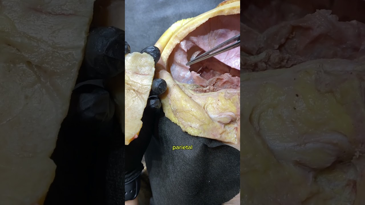 VISTA LATERAL DO CRÂNIO COMO VOCÊ NUNCA VIU‼️ #anatomia #odontologia #medicina