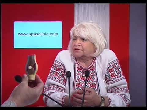Лечение суставов карловых варах Комплекс упражнений при артрозе коленного сустава