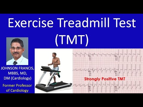 Exercise Treadmill Test TMT