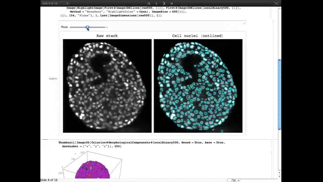 Mathematica in Cell Biology: Image Segmentation and Analysis of 3D Tumor Spheroids